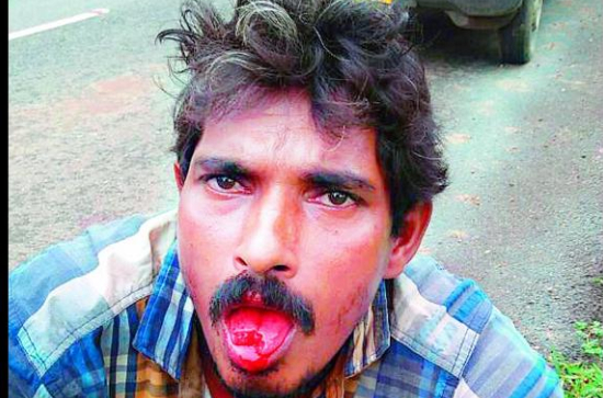 Person cuts his tongue in Banjara Hills over Andhra Politics